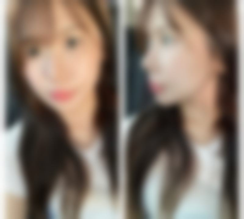 五、福州博美医疗整形美容门诊部实例