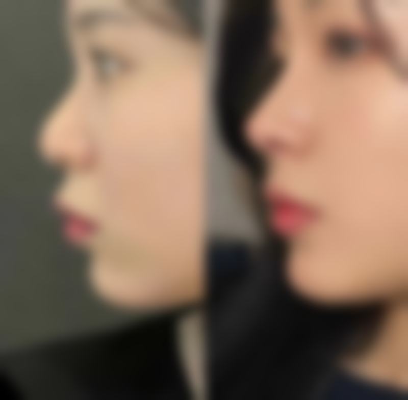 七、湖南常德伊丽莎白整形医院价格表:(仅供参考)