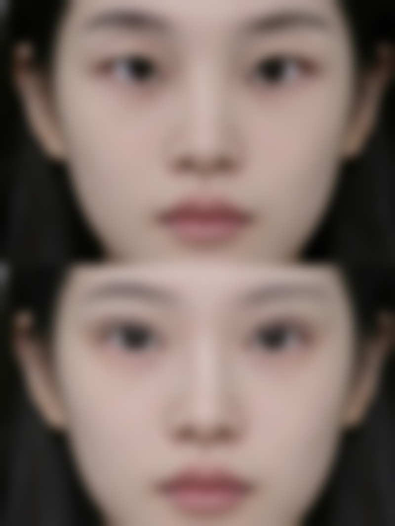 七、绵阳臻媛奥美恩医疗美容诊所价格表：（仅供参考）