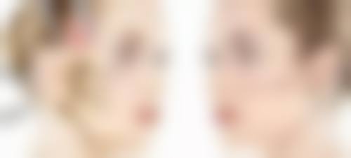 VE去除眼袋的使用方法大揭秘