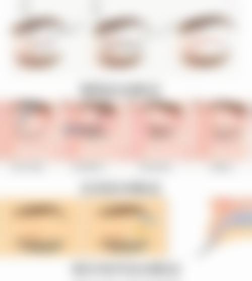 VE能否去除眼袋？怎么用？揭秘其抗氧化保湿、促进循环改善眼袋的秘诀 