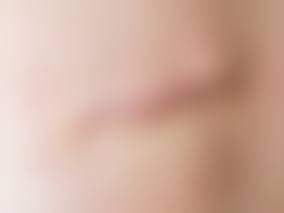 七、广东省第二中医院皮肤科价格表:(仅供参考)