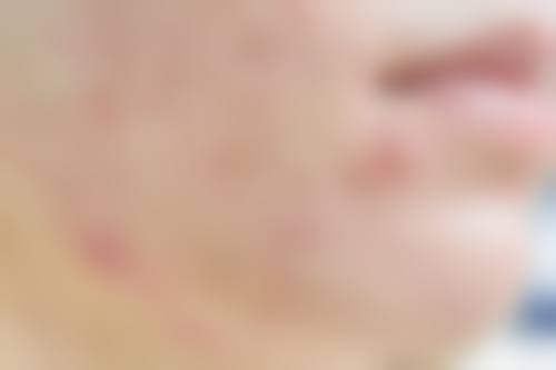 二、广东省第二中医院皮肤科正规吗?来看看医院资质: