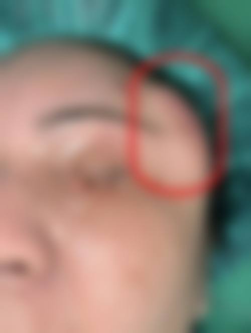 八、清远清城华美红妆整形外科门诊部真实的顾客评价如下：