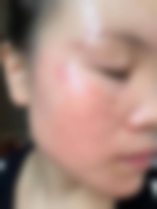 五、北京壹希光合医疗美容诊所实例