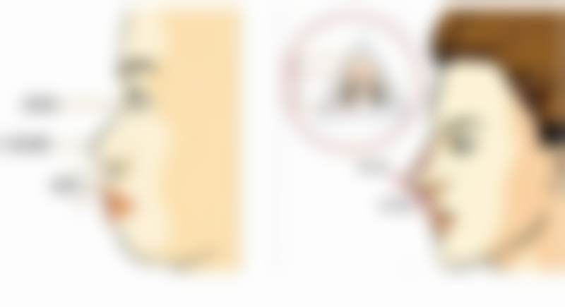 广州高尚医学美容中 心梁衍炜的吸脂塑形优势