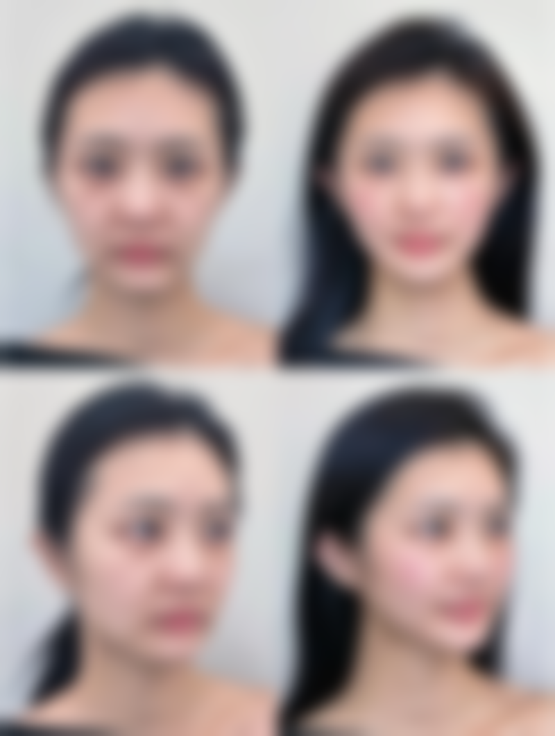 八、北京壹希光合医疗美容诊所真实的顾客评价如下: