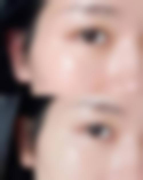 四、哈尔滨伊美尔光谱医疗美容门诊部实例