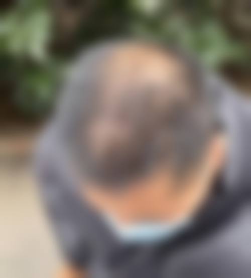 五、山西煤炭中 心医院美容整形科实例