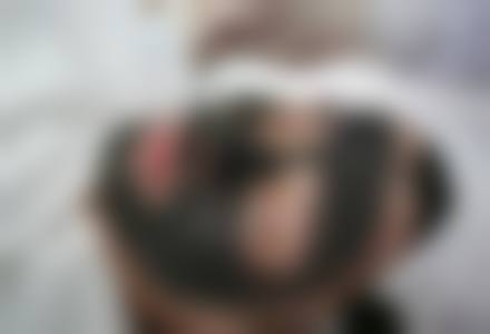 五、哈尔滨伊美尔光谱医疗美容门诊部怎么预约：