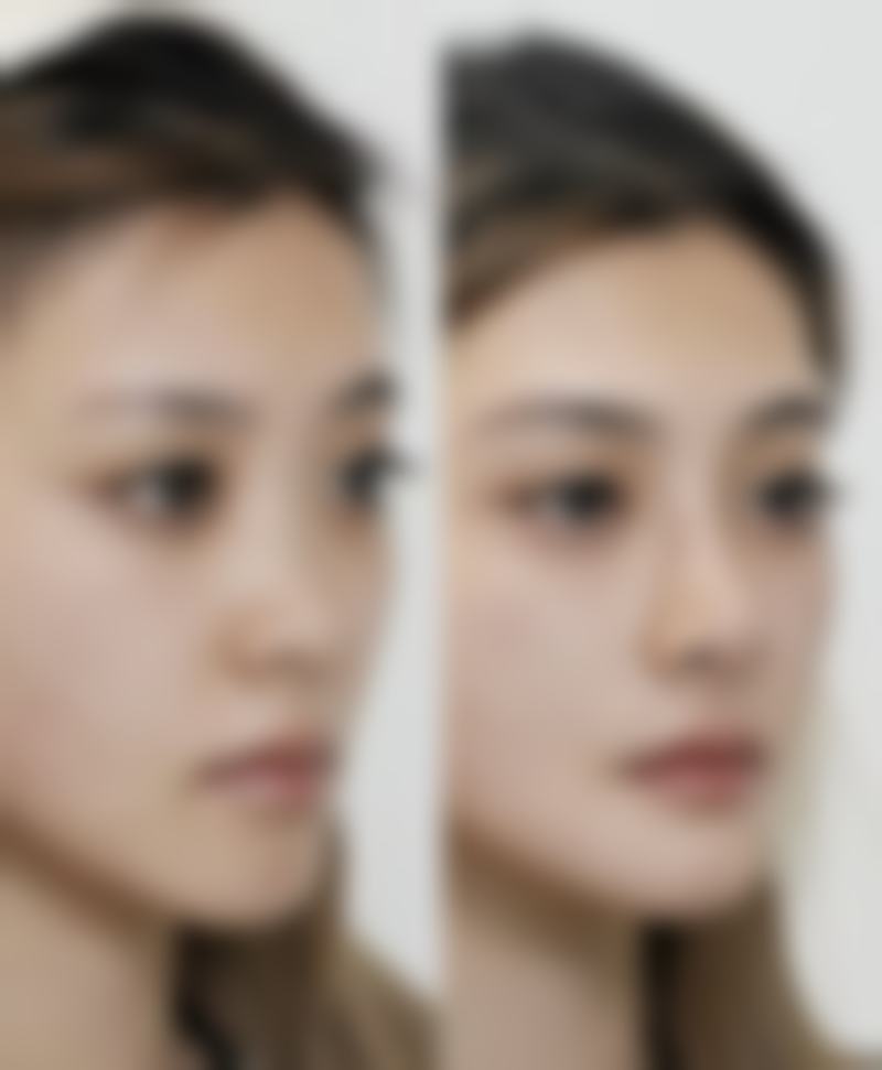 五、中山美尔医疗美容整形门诊部实例