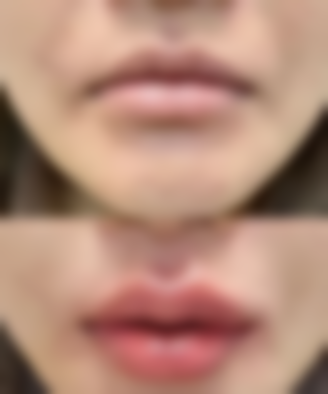 七、哈尔滨伊美尔光谱医疗美容门诊部真实的顾客评价如下：