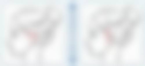 影响割双眼皮修复的因素分析