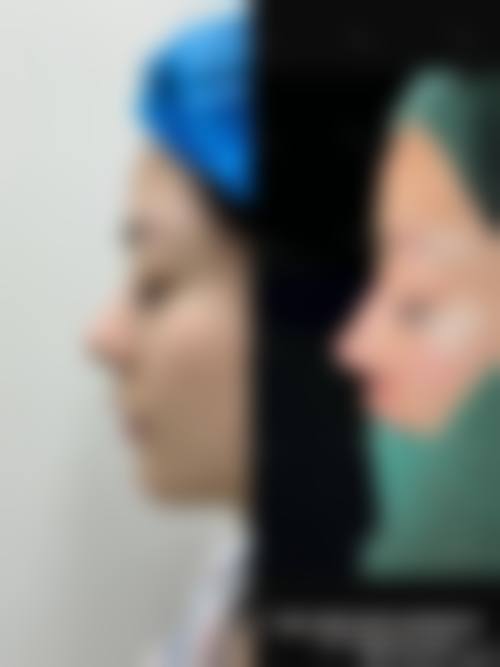 八、泉州亿星医疗美容门诊部真实的顾客评价如下: