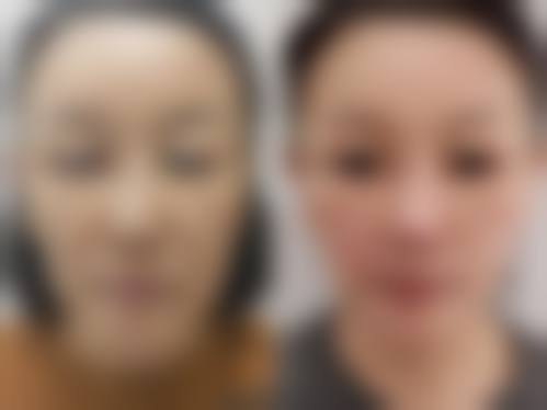 八、富来慕医疗美容整形医院真实的顾客评价如下：