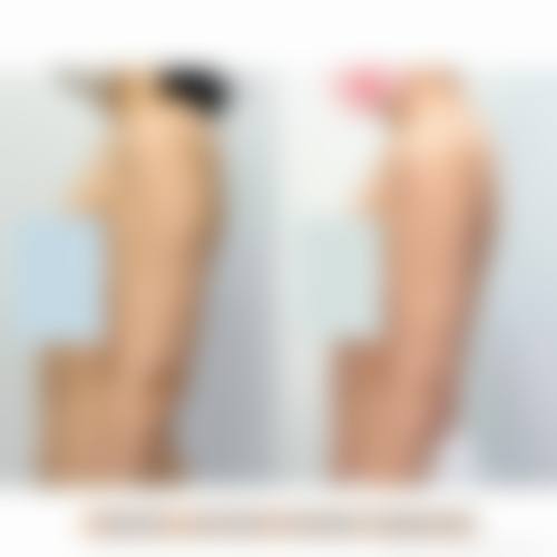 八、上海晨熹颜悦医疗美容门诊部真实的顾客评价如下: