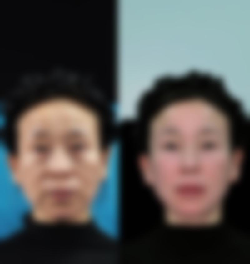 五、上海蛋白皮肤管理中 心（上海亚柏）实例
