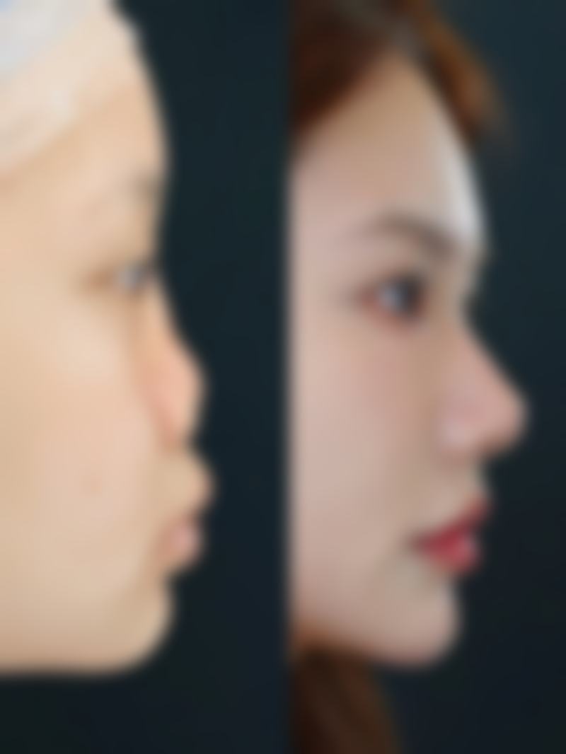 八、杭州艺之花医疗美容诊所真实的顾客评价如下：