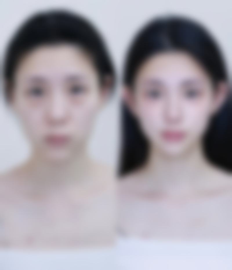 六、富来慕医疗美容整形医院怎么预约：