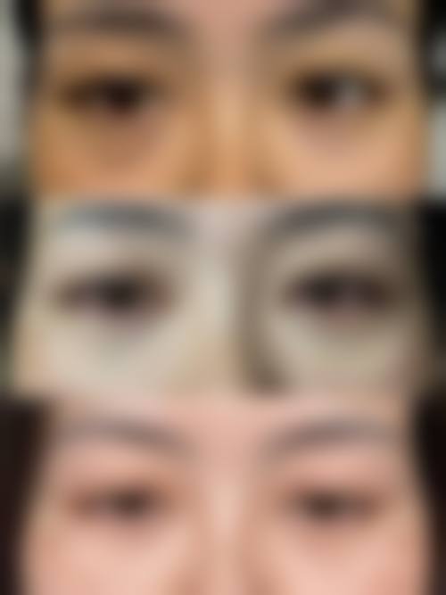 七、北京贝拉国内外整形医疗美容中 心价格表：（仅供参考）