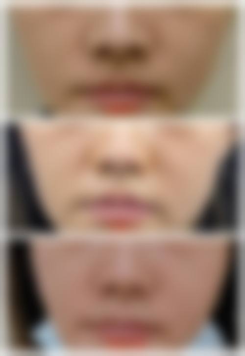 三、佛山东方（顺德）中韩整形美容医生介绍: