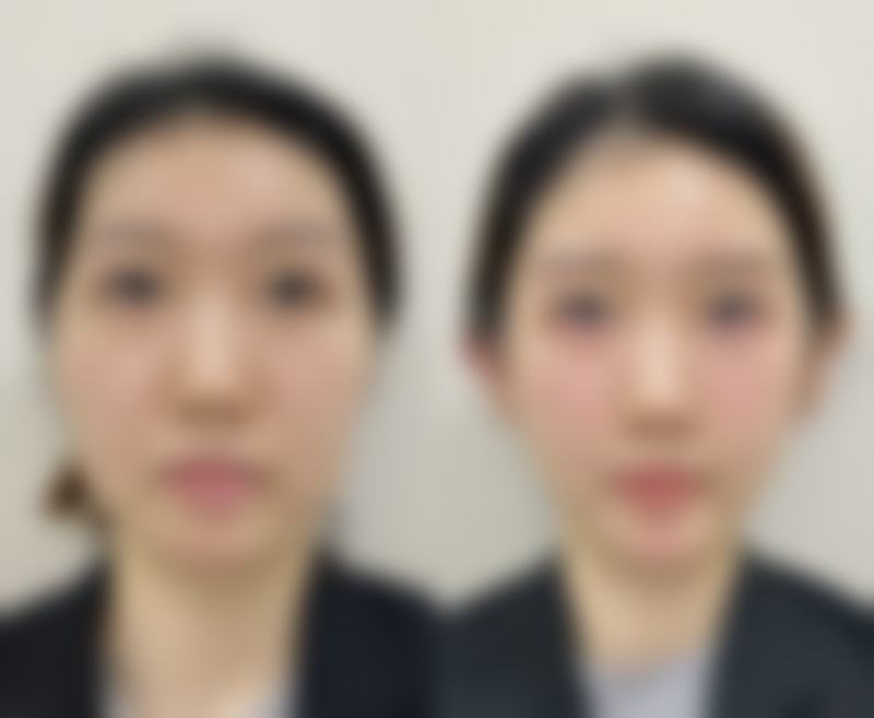 六、北京贝拉国内外整形医疗美容中 心怎么预约：