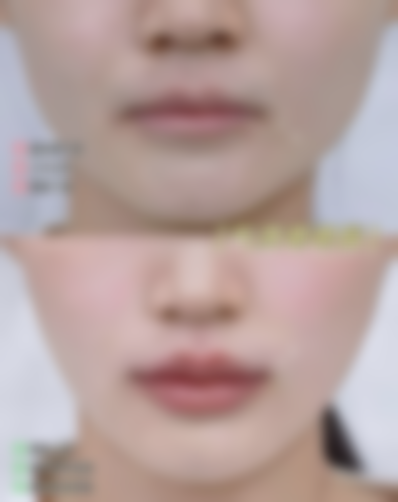 青岛瑧妍美医疗美容医院金哲医生值得了解