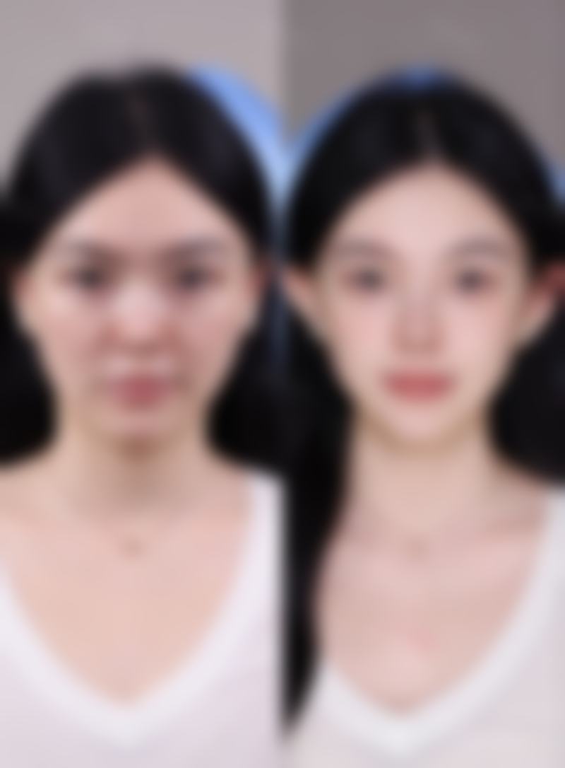 七、西安曲江新区礼知高美医疗美容诊所真实的顾客评价如下：