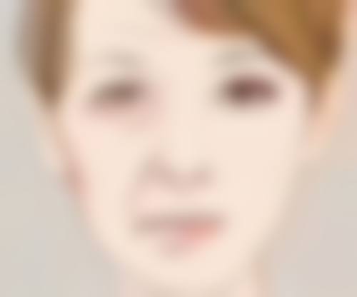 瘢痕体质激光治疗：综合优势与前景展望