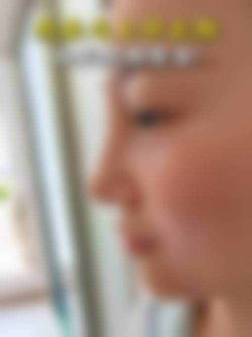 五、上海幼泡医疗美容诊所实例