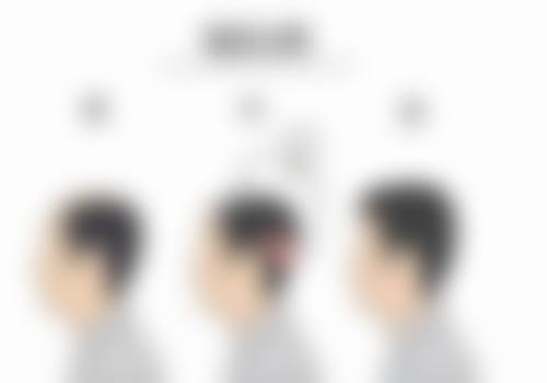 四、上海淮海智美整形医院实例