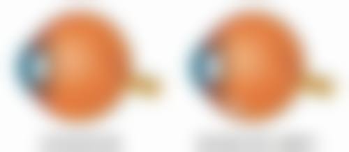 除皱针注意要点大揭秘！术前用药禁忌与机构产品选择