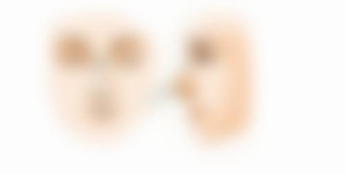 费用参考及术前注意事项有哪些？做好充分准备