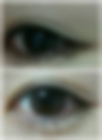 二、淮北微悦美莱坞整形医疗美容门诊部正规吗？来看看医院资质：