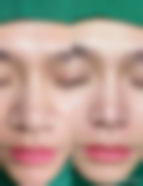 八、淮北微悦美莱坞整形医疗美容门诊部真实的顾客评价如下：