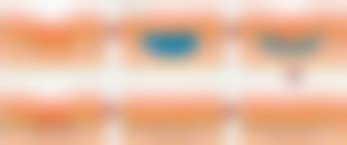 五、香港中西美生堂医学整形美容中 心实例