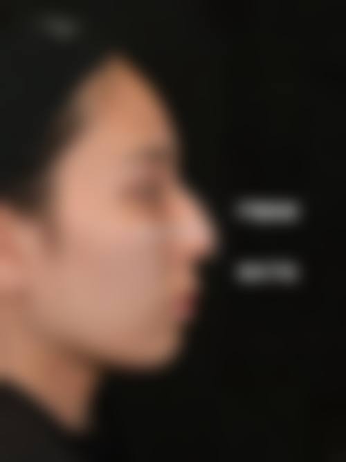 周冉医生怎么样可靠吗？