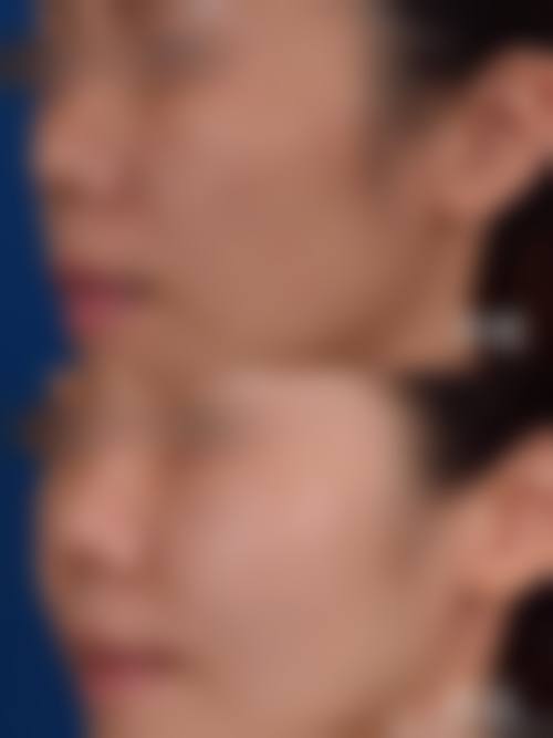 七、洛阳雅美嘉医疗美容门诊部价格表：（仅供参考）