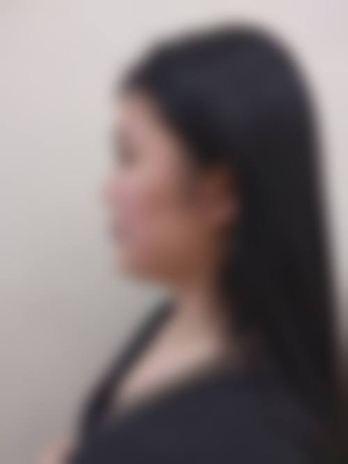 四、西安华医天美医疗美容门诊部实例