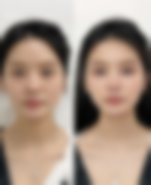 六、香港中西美生堂医学整形美容中 心怎么预约：