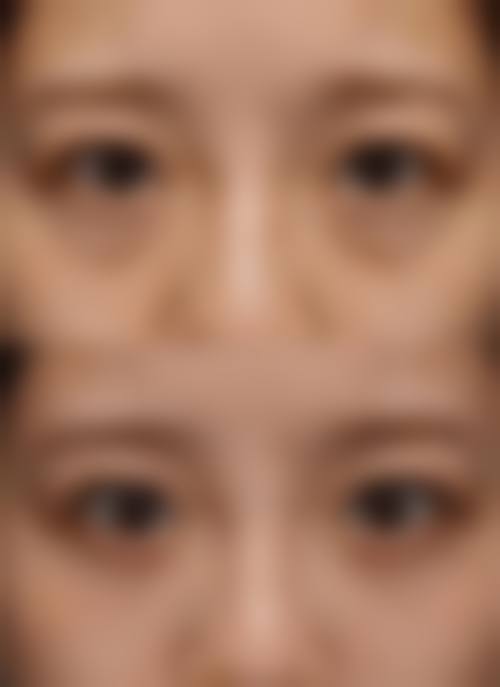 七、呼和浩特诺伊美医疗美容医院价格表:(仅供参考)