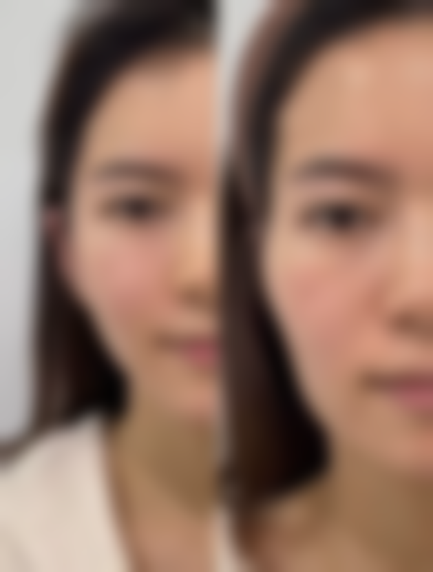 五、南昌方大医疗美容实例