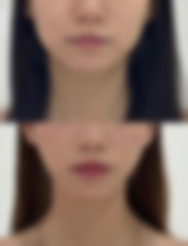 八、广州智媄整形医疗门诊部真实的顾客评价如下: