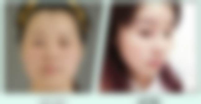 北京禾美嘉医疗美容门诊部关几梦:其他脂肪整形项目