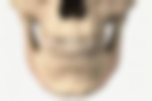 线提升后护理的要点