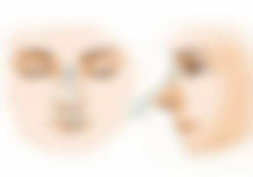 体质因素如何影响一次除皱针成效的维持时长？
