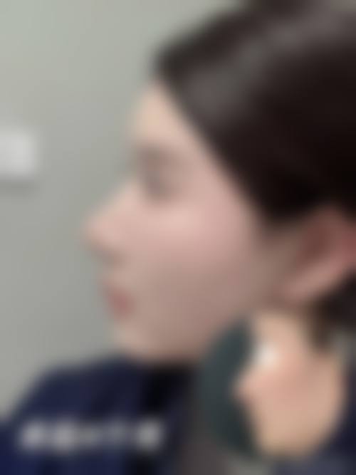 七、昆明大陆医疗整形美容医院价格表：（仅供参考）