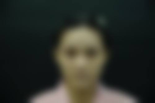 五、郑州魏荷花医疗美容整形医院实例