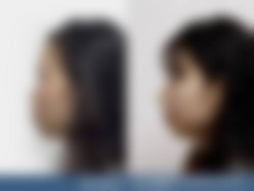 七、郑州魏荷花医疗美容整形医院价格表：（仅供参考）