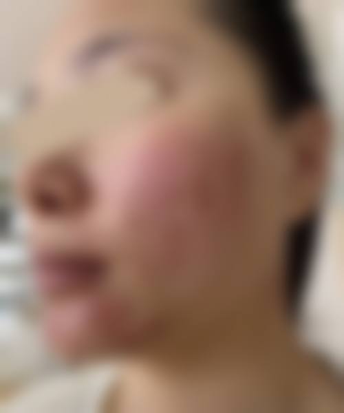 唐善华医生在哪家医院怎么预约？